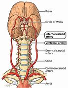 Image result for Internal vs External Carotid Artery