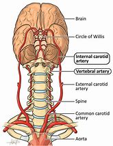 Image result for Carotid Artery Map