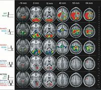 Image result for Sleep-Dependent Memory Consolidation