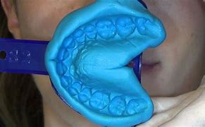 Image result for Addition Silicone Material