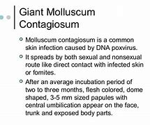 Image result for Molluscum Simplex