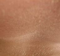 Image result for Vellus Hair Part