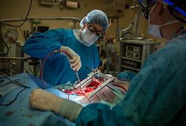 Image result for Open Heart Surgery Chest