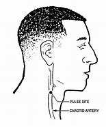 Image result for Carotid Artery Palpation