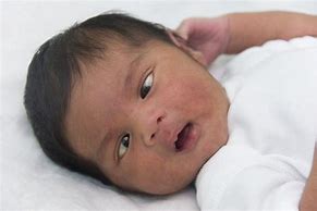 Image result for Cross Eyed Newborn