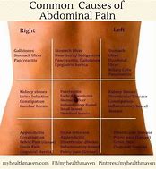Image result for Body Pain Left Side Abdomen
