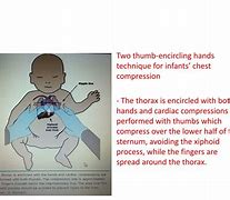 Image result for Encircling Hands Technique