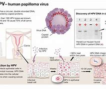 Image result for HPV DNA