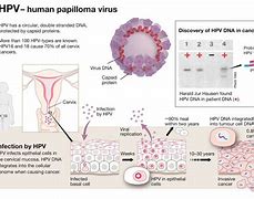 Image result for Research On HPV