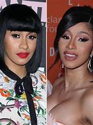 Image result for Cardi B Before Surgery