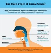 Image result for Throat Cancer Live Pics