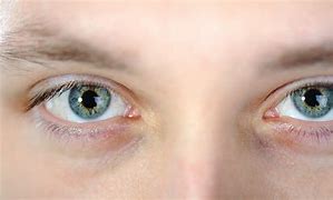 Image result for Covid Eyes Symptom