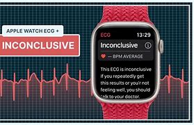 Image result for Inconclusive EKG Apple Watch