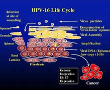 Image result for Disease Caused by Human Papillomavirus