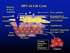 Image result for Human Papillomavirus Stages