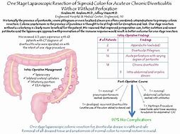 Image result for Diverticulitis Colon Removal