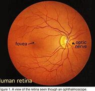 Image result for Retina and Optic Nerve