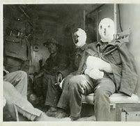 Image result for Mustard Gas WW1 Effects