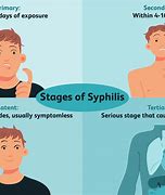 Image result for Syphilis Cure