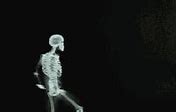 Image result for Funny X-ray Memes