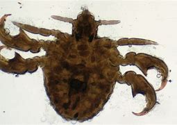 Image result for Crabs STD