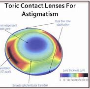 Image result for Toric Contact Lenses CooperVision