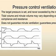 Image result for Pressure Control Ventilation