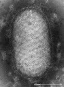 Image result for Molluscum Contagiosum Virus