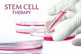 Image result for Stem Cell Therapy Products