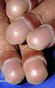 Image result for One Inch Nails On Fingers