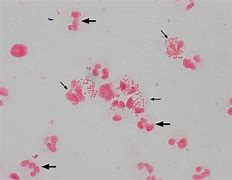 Image result for Diplococci Gram Stain
