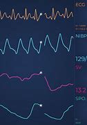 Image result for Samsung Health Monitor App ECG
