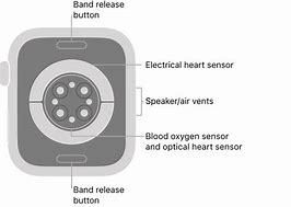 Image result for Apple Watch Allergy