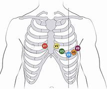 Image result for ECG