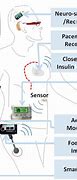 Image result for Wearable Diagnostic Devices