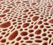 Image result for Trypophobia Worms