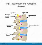 Image result for intervert4bral