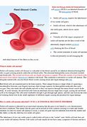 Image result for Sickle Cell Anemia Eyes