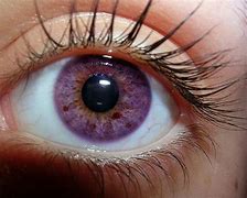 Image result for Purple and Pink Eyes