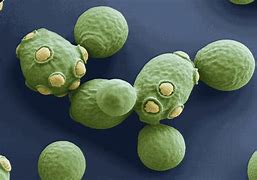 Image result for What Is Yeast