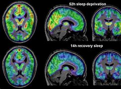 Image result for Brain without Sleep