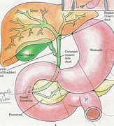 Image result for Peri Pancreatic Cancer