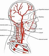 Image result for Internal vs External Carotid Artery