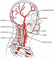 Image result for Internal Carotid and Vertebral Arteries