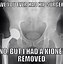 Image result for Funny X-ray of Brain in Knee