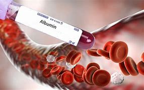 Image result for albumin�metto
