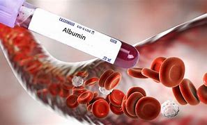 Image result for albuminpideo