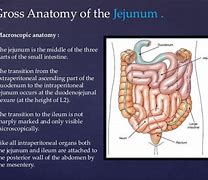 Image result for Jejunum