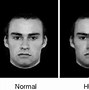 Image result for Facial Symmetry