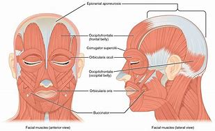 Image result for Facial Hemisection Encephalocele
